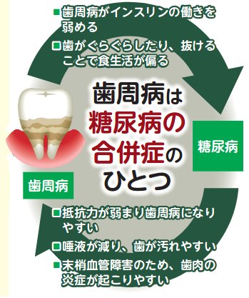 歯周病と糖尿病の関係
