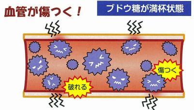 過剰に増えたブドウ糖が血管を傷づける様子