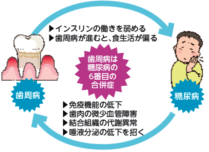 歯周病と糖尿病の関係